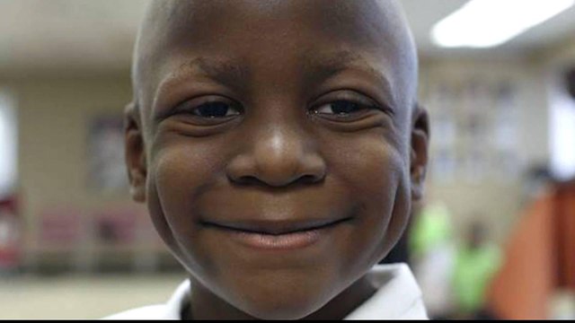 US study links poverty to low cancer survival rates