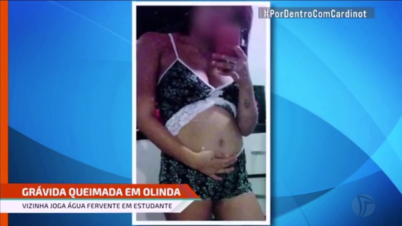 Grávida queimada por vizinha em Olinda