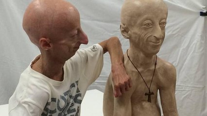 Sammy Basso: El italiano de 22 años que parece un anciano