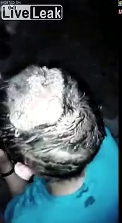 Maladie - la tête infestée de vers ! c'est vraiment horrible..