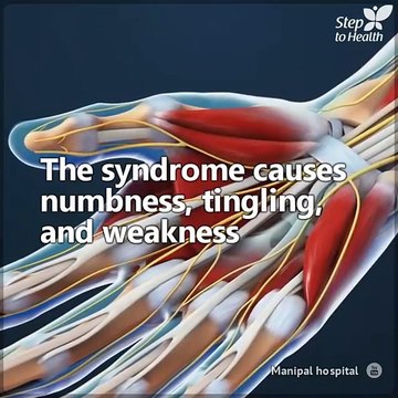 3 simple strategies for relief from Carpal Tunnel Syndrome