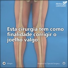 Explicamos como é realizada uma cirurgia corretora de joelho valgo
