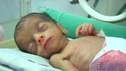 مخاوف أممية من موجة ثالثة من الكوليرا باليمن