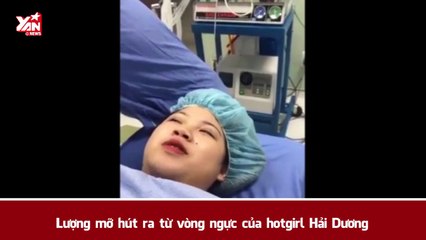Ngỡ ngàng với lượng mỡ hút ra của hotgirl Hải Dương