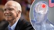 What is glioblastoma, the brain cancer that killed John McCain?