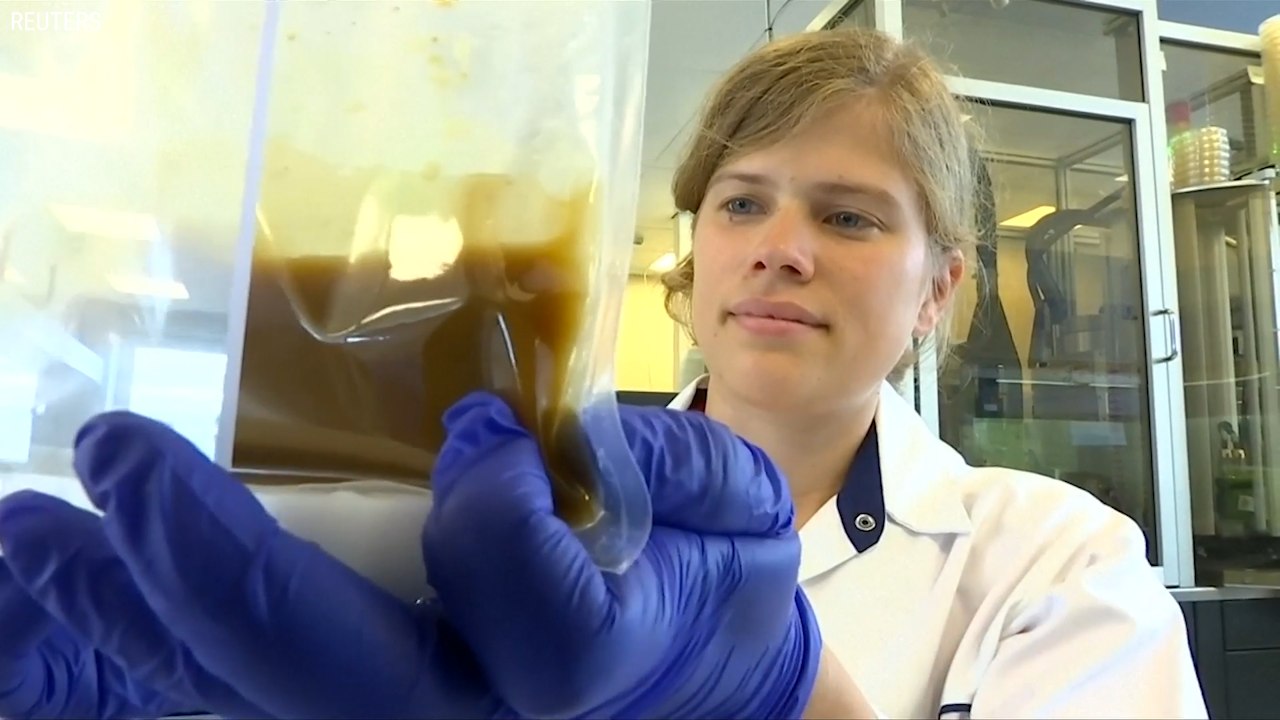Belgian Scientists Hope To Find Cures For Illnesses Through Poo
