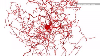 Scientists Discover Mysterious New Type of Human Brain Cell