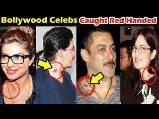 Bollywood के सितारे पकडे गए रंगे हाथो LOVE Bite के साथ, जानिए पूरी कहानी