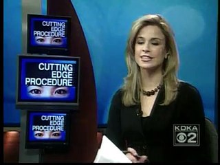 Eyelid Surgery | Michael Omidi, M.D., F.A.C.S.