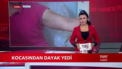 Kocasından Dayak Yedi