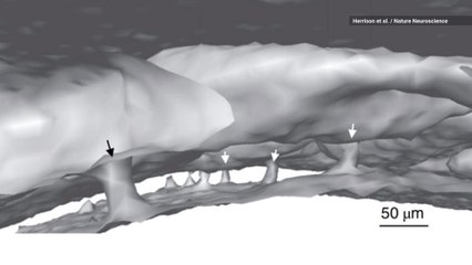 Researchers Discover Secret Tunnels Between Our Brain and Skull