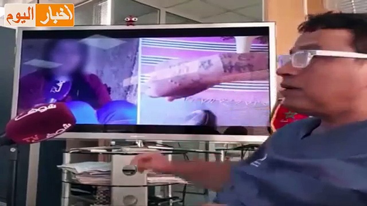 الدكتور التازي يكشف حقيقة قضية أوشام خديجة ضحية الفقيه بن صالح....."خطفوني ووشمو ليا"