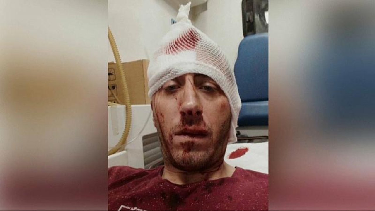 Nach Prügelattacke auf Reporter: Bosnische Journalisten demonstrieren