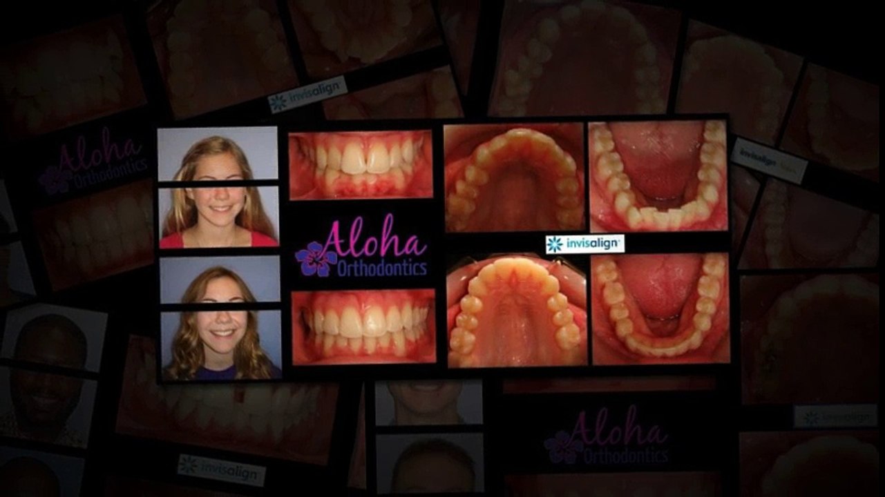 Orthodontist Las Vegas | aloha-orthodontics.com