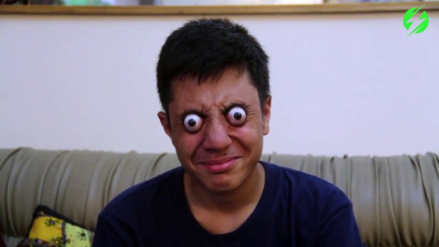 Ce qu'il fait avec ses yeux est fou... et surement douloureux