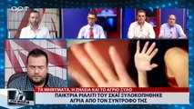 Παίκτρια ριάλιτι του ΣΚΑΪ ξυλοκοπήθηκε άγρια από τον σύντεροφό της (ΑΡΤ, 27/8/18)