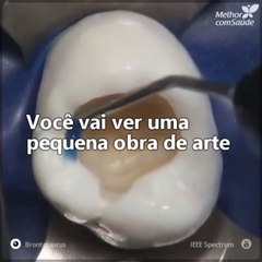 Embora ir ao dentista possa nos causar medo, os bons profissionais podem fazer verdadeiras obras de arte da odontologia, como você está prestes a ver. É impressionante!