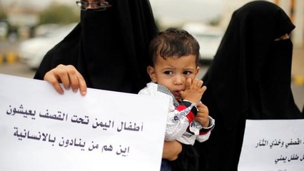 بعد التسبب بمقتل 40 طفلا.. التحالف السعودي: قصف حافلة ضحيان في اليمن غير مبرّر