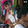 زنان کیوانی در میانمار از صد ها سال به این سو از حلقه های برنزی برای تزئین گردن شان استفاده کرده اند. استفاده از این نوع حلقه های برنزی، سمبول زیبایی در میان زن