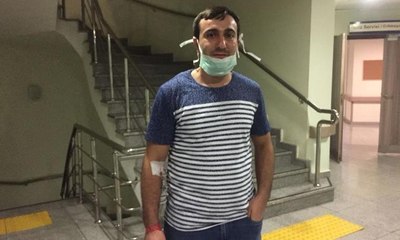 Şarbon şüphesiyle hastaneye kaldırılan Ayan'dan açıklama