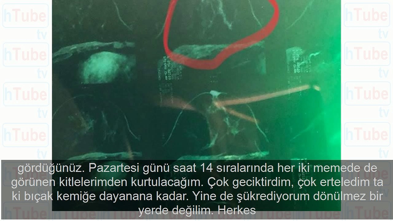 Fulden Uras'tan kötü haber! 'Benim için dua edin'