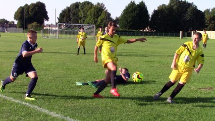 U18 AOUT 2018 CONTRE LE TREPORT