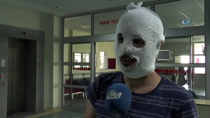 Merdiven Altı Krem Bu Hale Getirdi