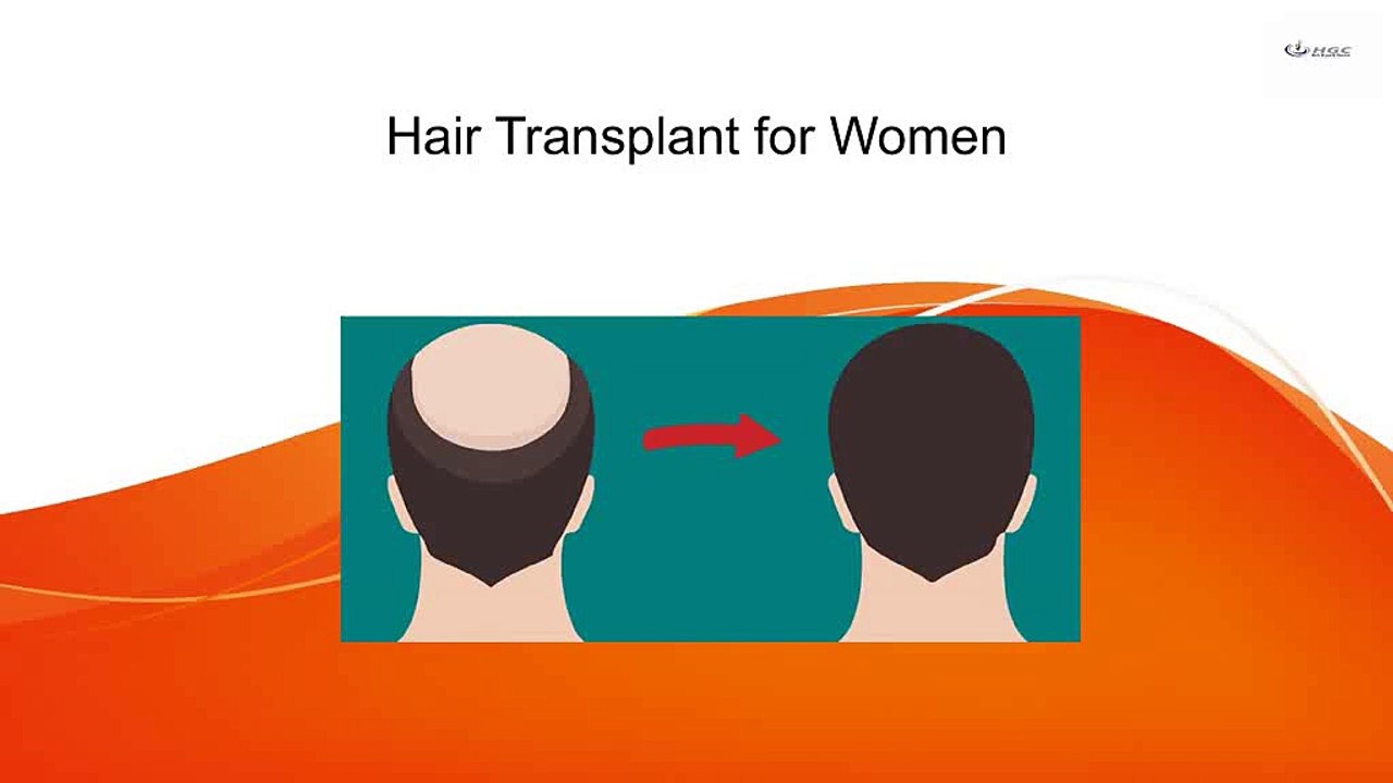 Hair_Transplant_for_Women_