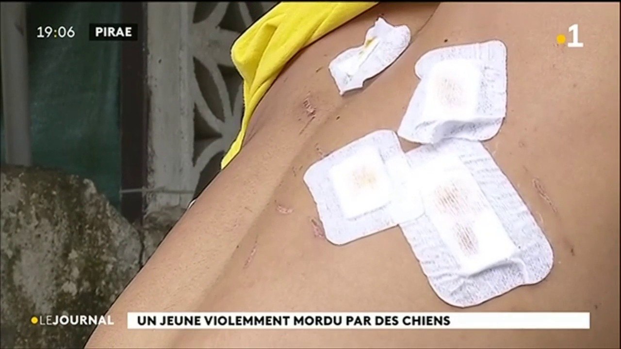 Chiens méchants : un jeune violemment mordu