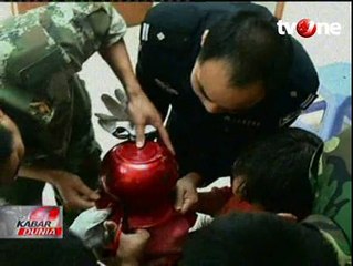 Kepala Bocah Ini Tersangkut di Dalam Mangkuk Logam