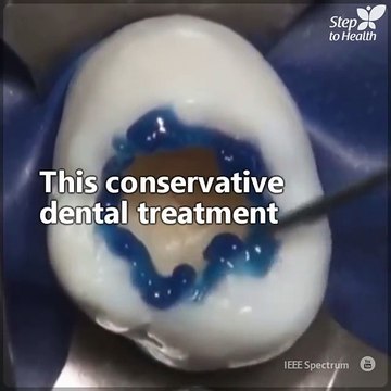 Going to the dentist may be scary sometimes, but the right professionals can do true odontological art, like you can see here. It's amazing!