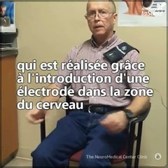 Une nouvelle chirurgie neurostimulatrice pour les patients atteints de la maladie de Parkinson