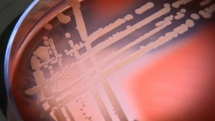 Ученые обнаружили супербактерию