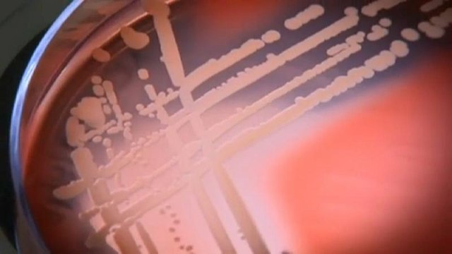 Ученые обнаружили супербактерию