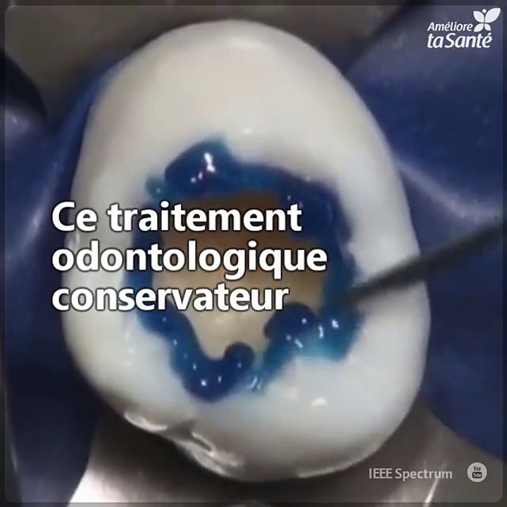Même si aller chez le dentiste peut nous faire peur, les bons professionnels peuvent réaliser des oeuvres d'art odontologiques comme celle que vous allez voir. Une véritable merveille !