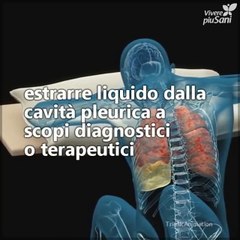 Ti spieghiamo come si realizza una toracentesi