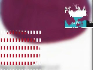 Explore Unique Moiré Kippahs – Stylish & Diverse Options ✨