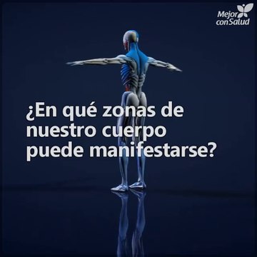 La candidiasis, una enfermedad desconocida con síntomas comunes.