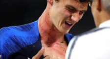 Almanya - Fransa Maçında Yıldız Futbolcunun Boğazı Perişan Hale Geldi