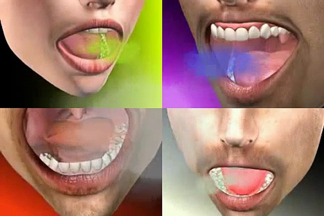 woher kommt Mundgeruch