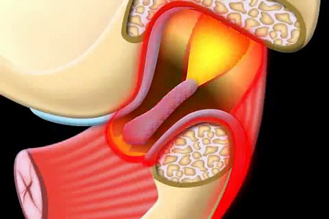 Was tun bei Kiefergelenkschmerzen