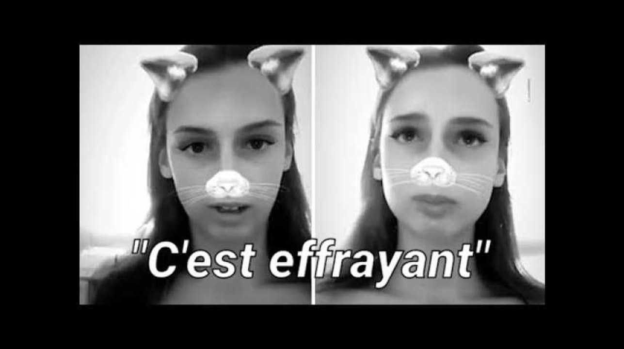 Cette mannequin atteinte d’épilepsie se filme en pleine crise sur Instagram