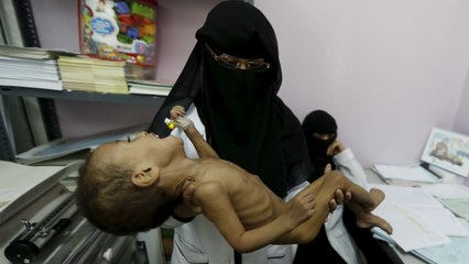 മൂന്ന് വർഷത്തിനിടെ കൊല്ലപ്പെട്ടത്  85000 കുട്ടികൾ | #Yemen | Oneindia Malayalam