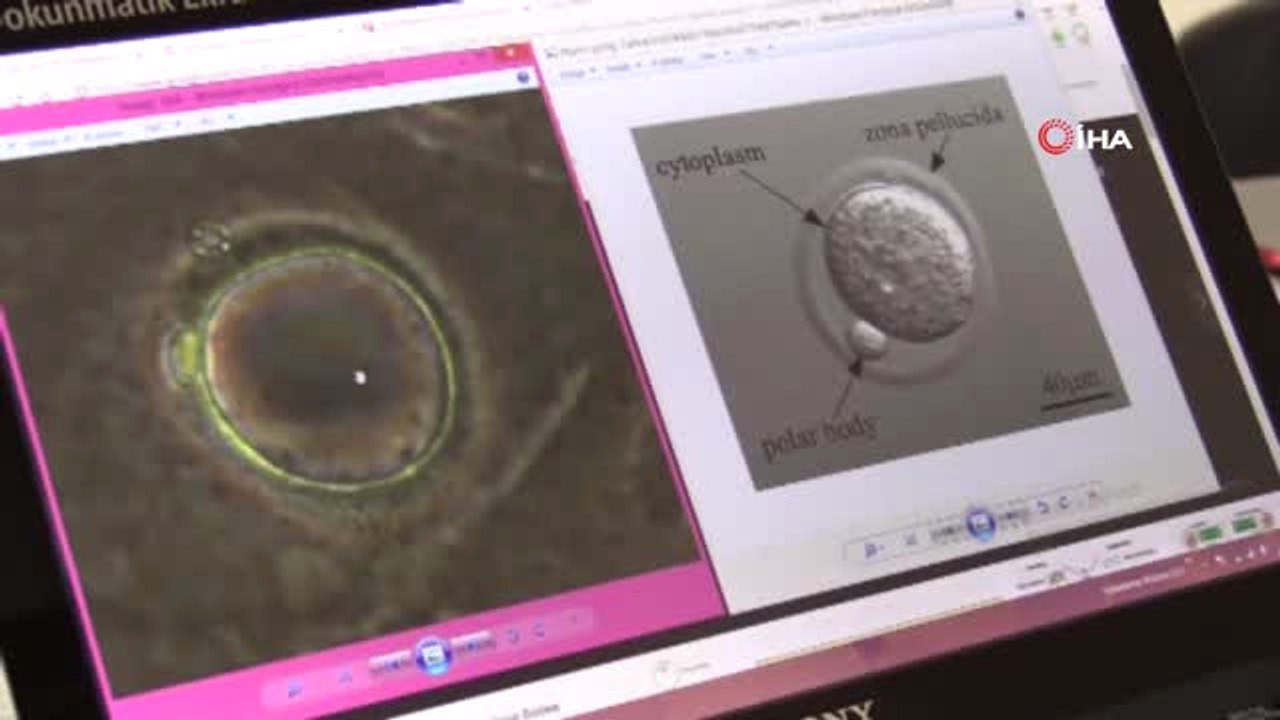 Erken Yumurtalık Yaşlanmasına Karşı Çığır Açacak Çözüm...yumurtalık Kaynaklı Yüzey Kök Hücreleri...