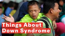 5 Things To Know About Down Syndrome