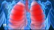 RTG -  Ce qu’il faut savoir sur les maladies respiratoires