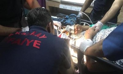 Elini kıyma makinesine kaptırdı