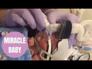 Meet incredible baby Grace born FOUR MONTHS premature