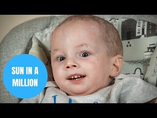 Toddler will spend life in darkness because he is allergic to sunlight