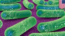 Bakteri sintetik: Probiotik dimodifikasi dapat bantu pasien PKU - TomoNews